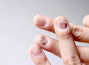 Sparsh Skin and Allergy Clinic in Mathura , Skin treatment in mathura, Skin clinic in mathura, laser treatment in mathura, Hair treatment in mathura, Best skin clinic in mathura