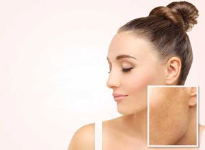 Sparsh Skin and Allergy Clinic in Mathura , Skin treatment in mathura, Skin clinic in mathura, laser treatment in mathura, Hair treatment in mathura, Best skin clinic in mathura